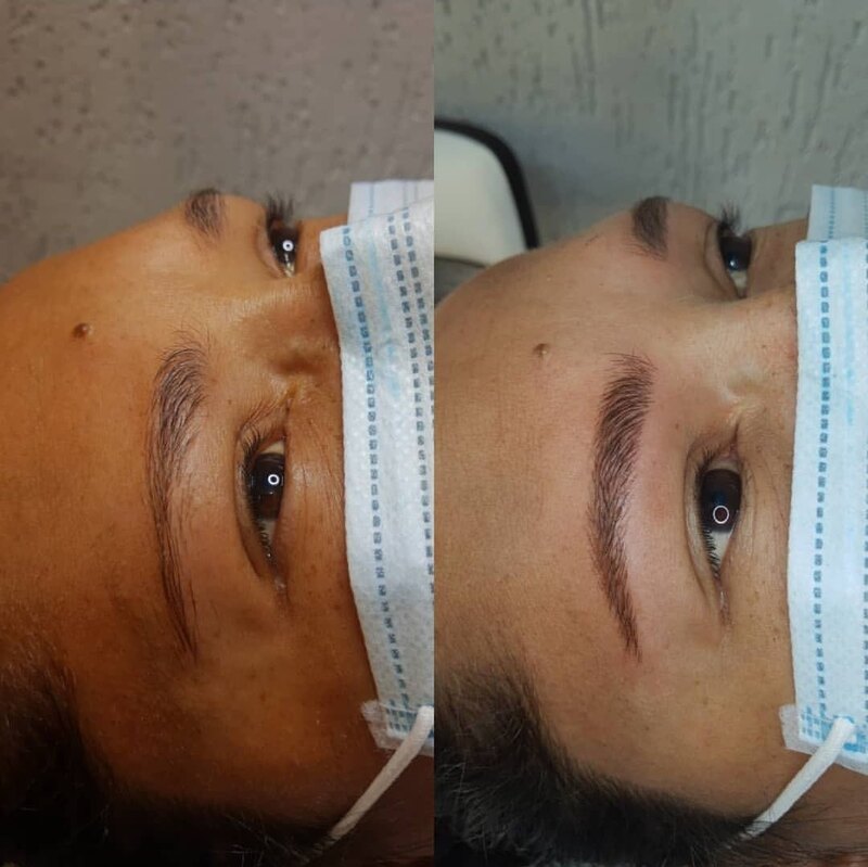Sobrancelha antes e depois